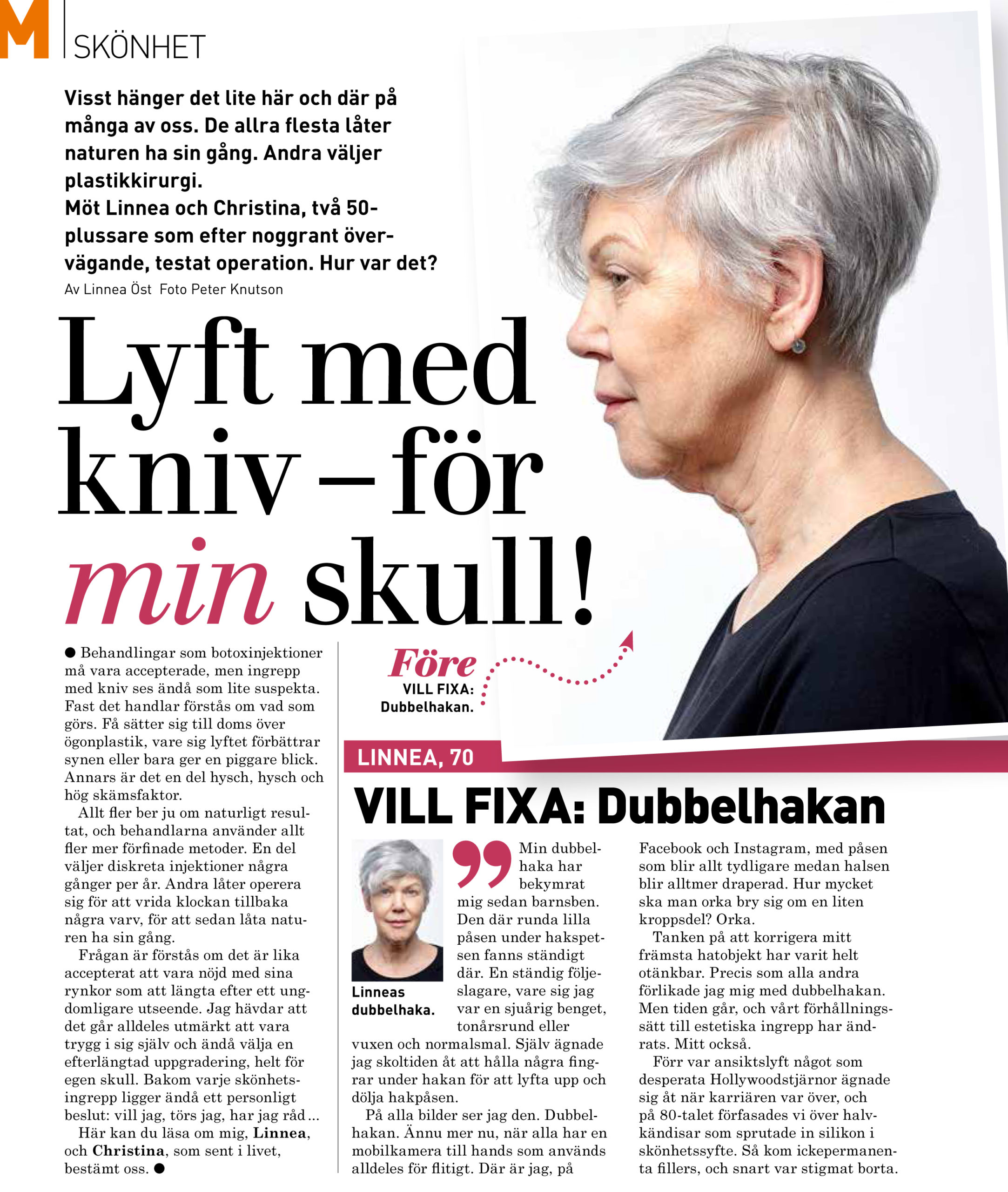 Del 1 Artikel om halslyft i M-magasin