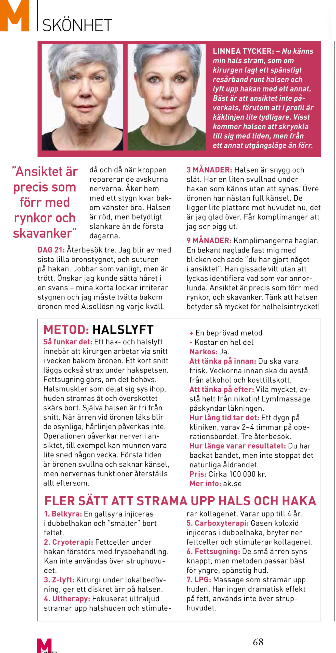 Del 2 Artikel M magasin Halslyft